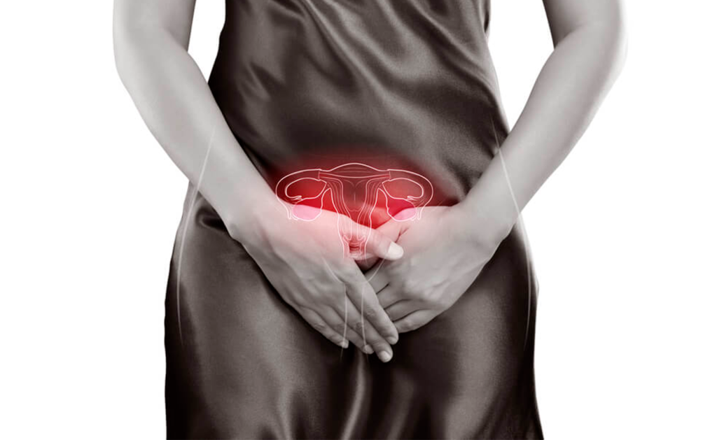 Endometriosis​